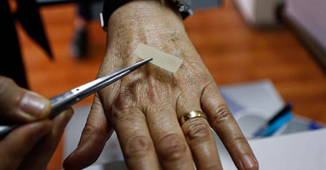 Türk bilimciler örümceğin kozasından doku onarım malzemesi üretti